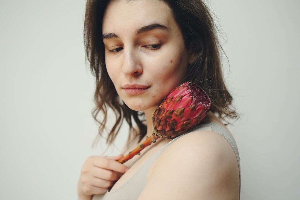 A Woman With Acne Holding a Flower